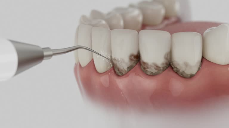 Reliable Dental contractor in Celina, TX by Smile Center Dentistry